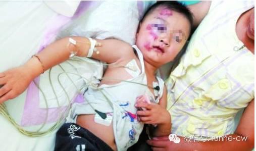 4歲男童從3樓摔下來滿身是血,當大家心疼的想抱起孩子的時候、男童的母親竟叫大家「住手」!