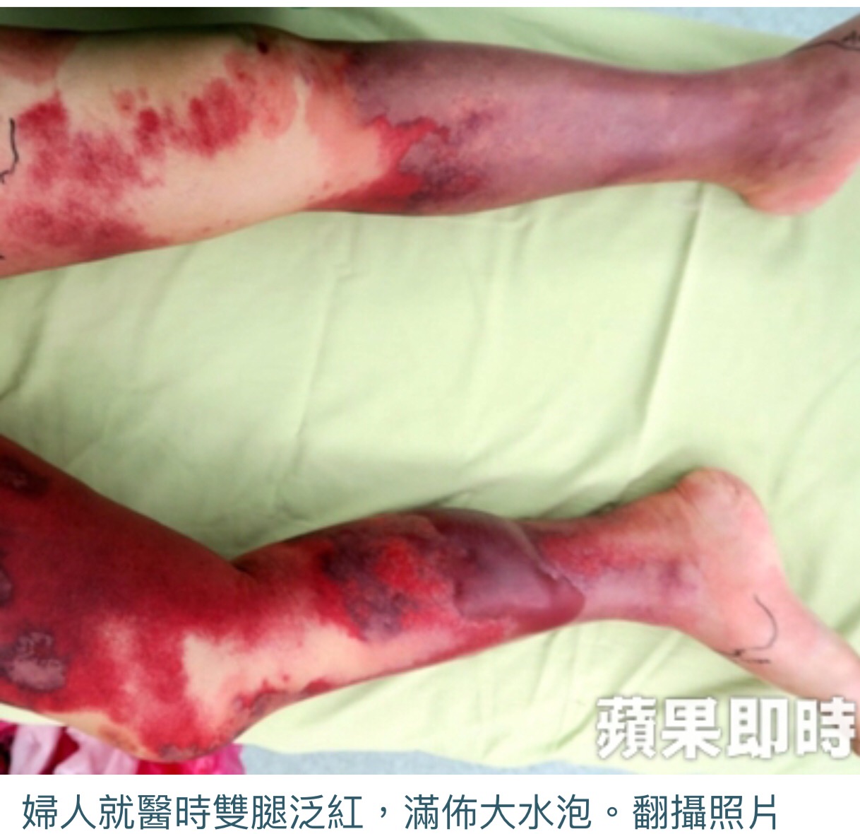 不過吃個海鮮 怎麼會差點少兩條腿