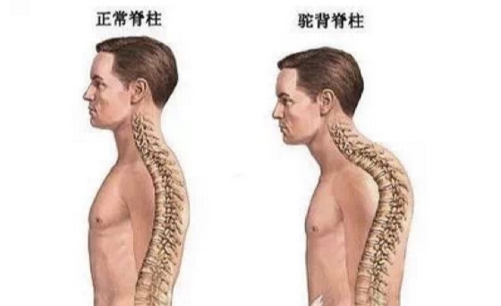 太棒了!只要做這五個動作...背痛,腰痛,頸椎痛都好了!老實做一周我整個人挺起來變得光鮮亮麗!