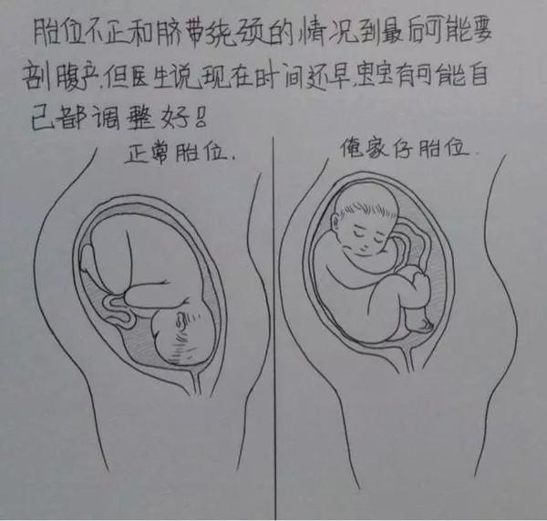 老婆辛苦懷孕生子,老公妙筆點滴記錄,看哭千萬人!
