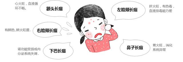 為什麼痘痘反覆難祛?男女有別,避免誤區!清痘+除印