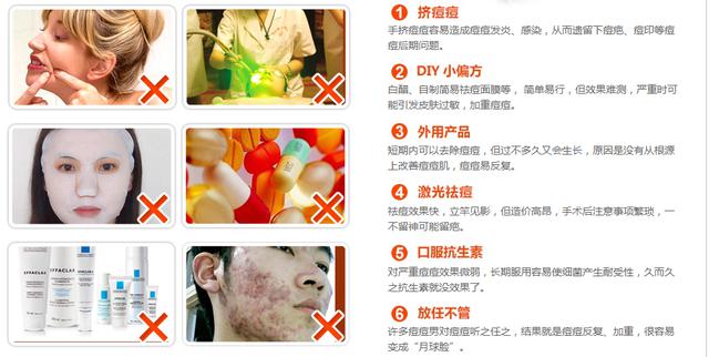 為什麼痘痘反覆難祛?男女有別,避免誤區!清痘+除印