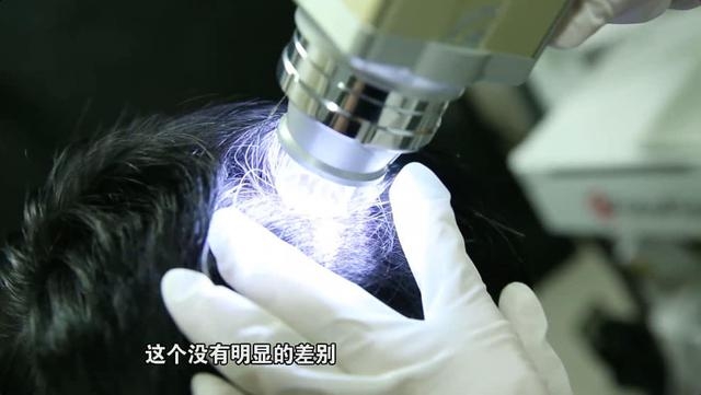 白頭髮越拔越多?你被騙了多少年 。。。