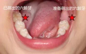 孩子換牙，長出的牙齒很醜、不整齊怎麼辦？