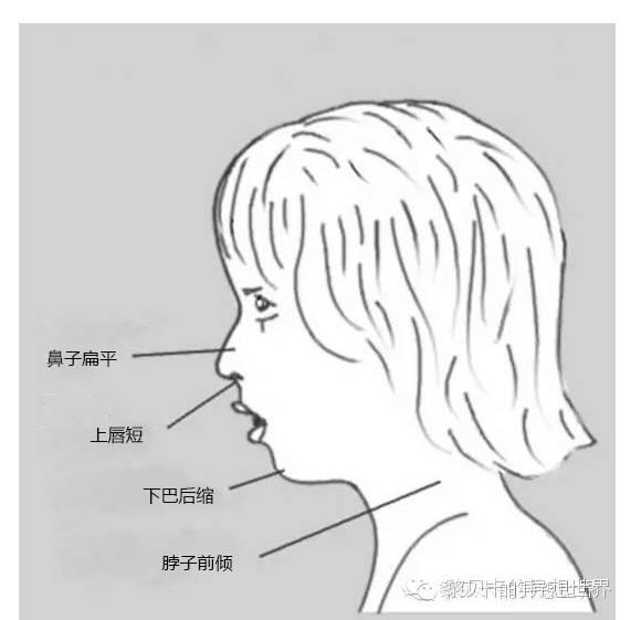 可怕|| 這些小習慣正在悄悄改變我們的臉