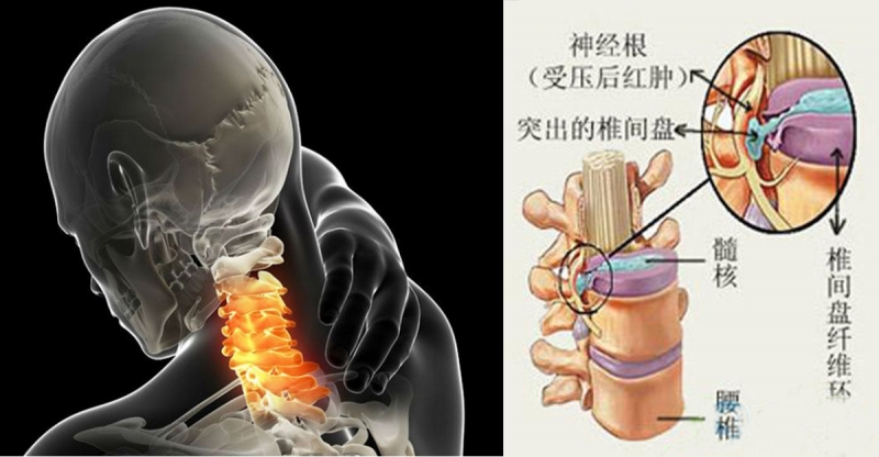 又一個不缺錢的死了！死因竟然是這種病！快把這幾招學起來保命啊