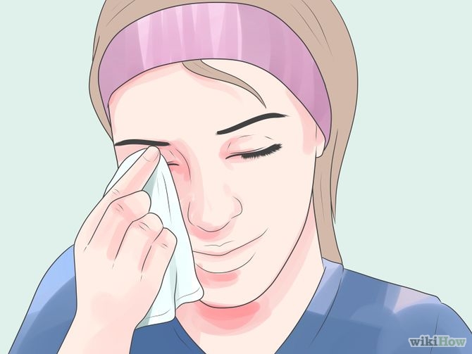 Get Rid of a Stye Step 8.jpg