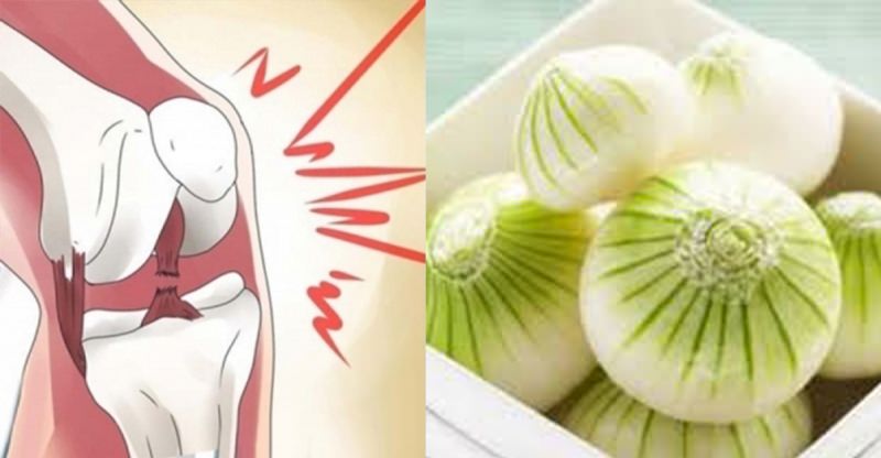 母親長年以來膝蓋總是出問題，沒想到「用洋蔥這樣做」之後不只不痛了，每天還可以出去慢跑！這必須告訴大家！