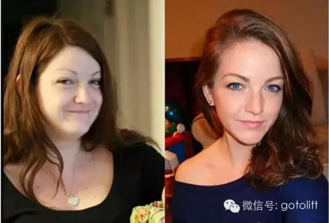 體脂率下降5%,變化竟然如此驚人,請告訴身邊減肥的人!