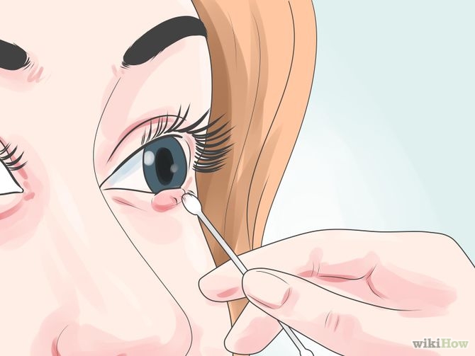 Get Rid of a Stye Step 1.jpg