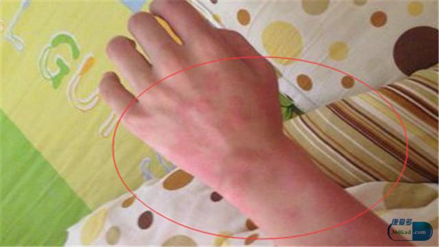 身體免疫力在下降的5個信號,你留意到了麼?