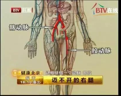 這個動作能讓你知道你的血管是否堵了,趕緊來測測!