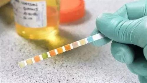 小便後看一眼能保命,1.3億人錯過了腎病的信號