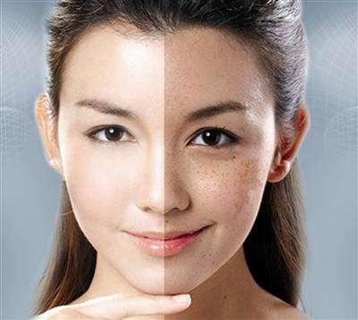 肝不說話，卻主宰著你臉上的斑