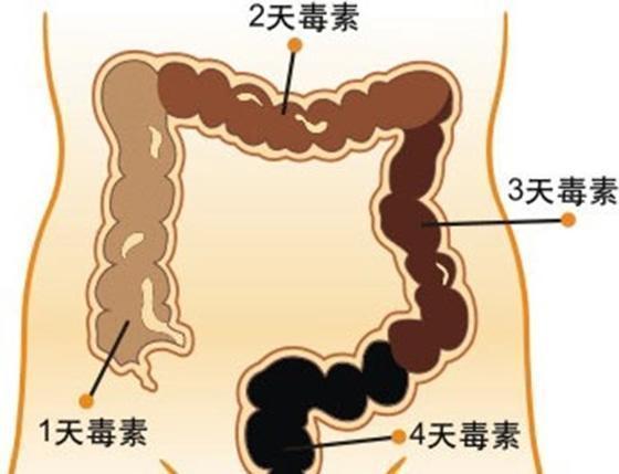 大便排不幹凈因為濕氣重,出現這些情況就要注意了,喝水加點「料」,排出腸道宿便更健康!