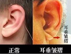 人猝死前身體發出兩個救命信號,一定要清楚