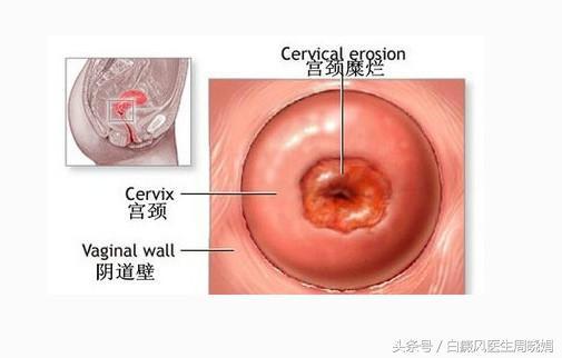 別亂花錢啦！ 6種大病讓人心慌，可能根本不用治