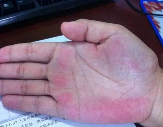 肝脏健不健康,只需要看外表4个特徵!