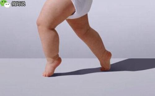 快看看你家寶寶的雙腿，出現這些問題到底該怎麼辦？