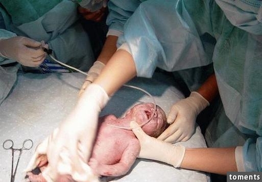 母親在產房準備迎接新生命，沒想到嬰兒竟從肛門「蹦」出來...！這場景連醫生都傻了！而真相居然是因為...