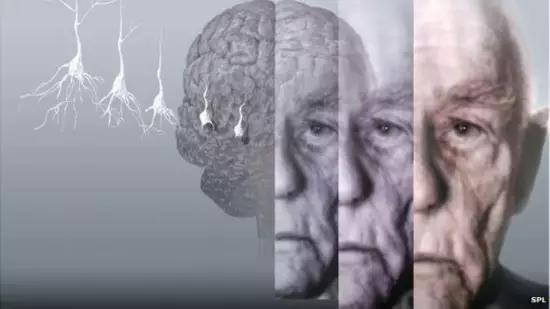 老年癡呆很可怕，沒想到預防如此簡單