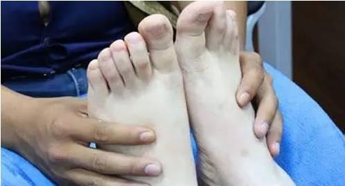 人壯憑腳健,腳是健康根!