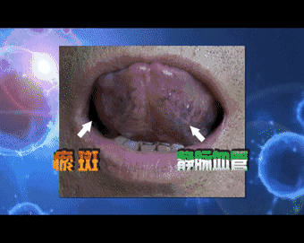 最全健康自測法,在家就能給自己從頭查到腳!