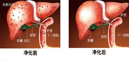 肝臟的解毒排毒能力有限，但配合吃這10種食物，效果加倍