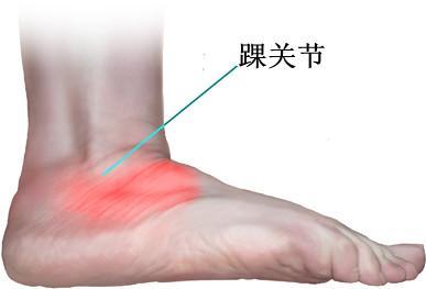 痛風會100%引發腎臟損害嗎? 腎內科醫生專業解答!