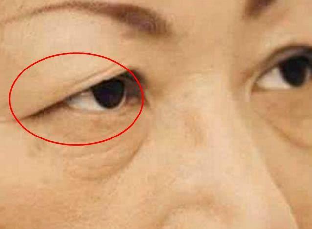一旦眼睛出現這8種症狀要當心，這可能是大病的徵兆，要及時就醫