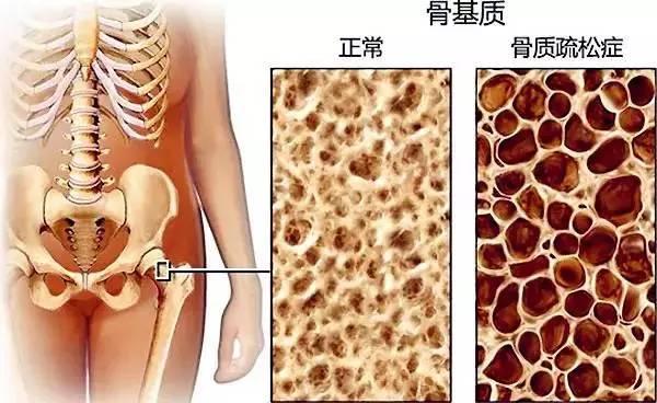 你的身體,從20 歲就開始老化了……