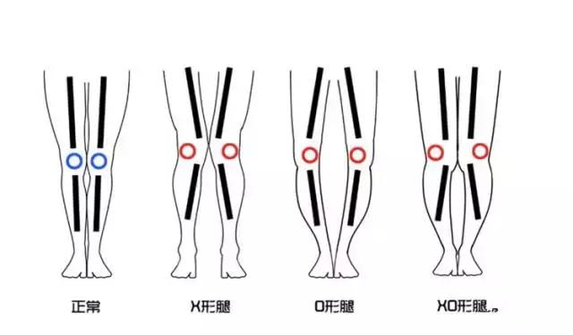 穿對褲子,你也可以擁有筷子腿