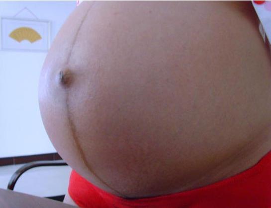 想要小公主？ 當你懷孕有這些症狀可能是懷了女寶寶！