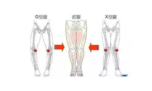 想要瘦腿，先了解導致自己粗腿的原因才能對症下藥啊