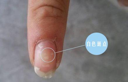 肝臟好不好,看看食指就知道!