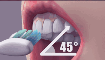 牙齒上的黑斑是蛀牙嗎? 保護牙齒要注意這10個因素