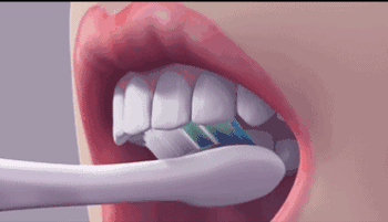 牙齒上的黑斑是蛀牙嗎？ 保護牙齒要注意這10個因素