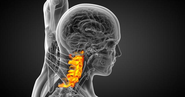 頸椎病也有6種類型,看看你是哪一種?