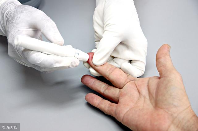 夏季是痛風“高發期”！ 做對5件事，痛風遠離你！