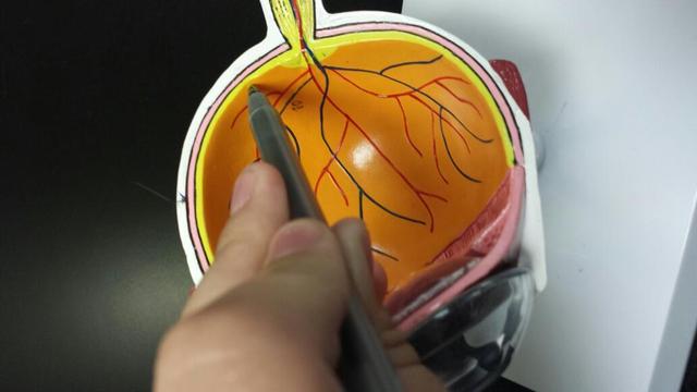 注意：眼睛上長出它，老年癡呆離你很近