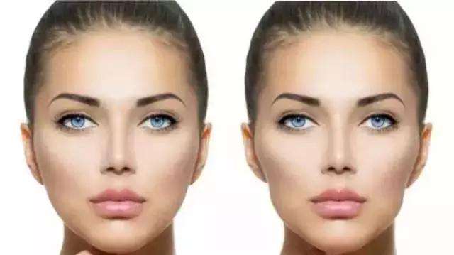 還在猶豫是否整牙，明星們默默變美都在靠它，你想知道的這篇都有