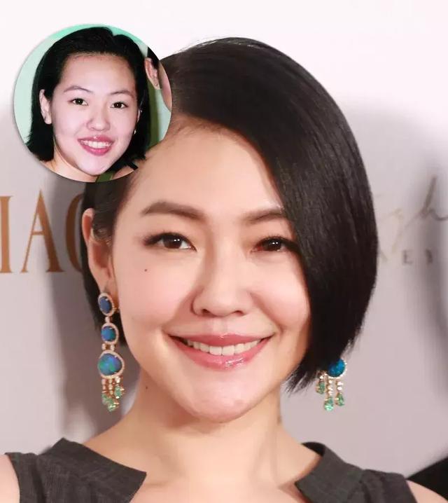 還在猶豫是否整牙，明星們默默變美都在靠它，你想知道的這篇都有