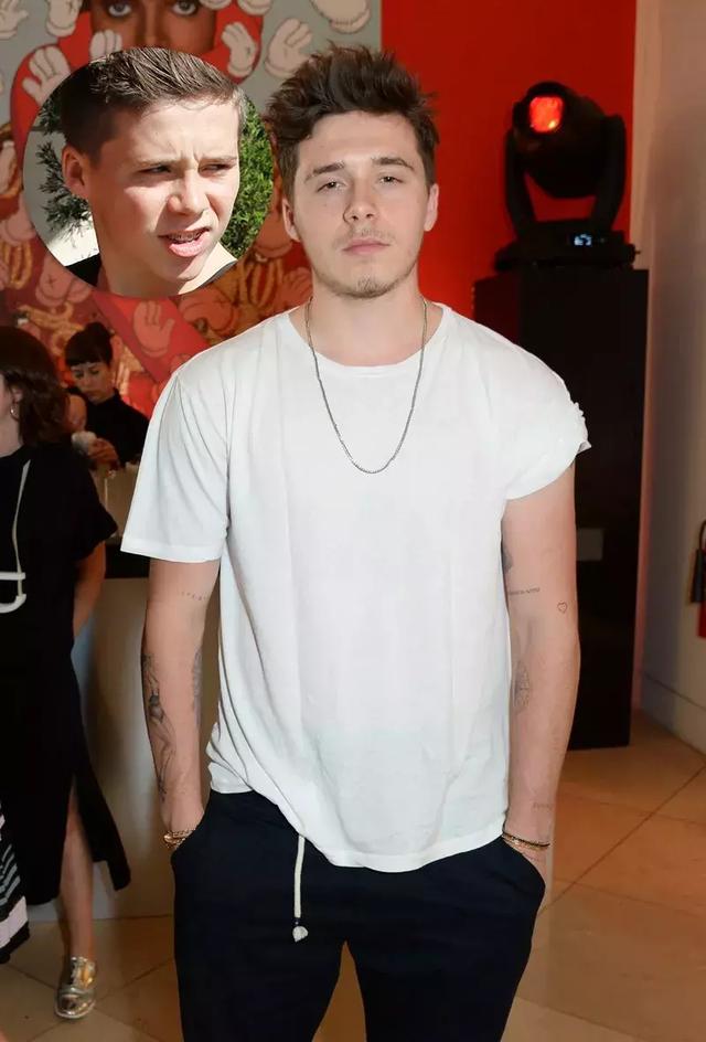 還在猶豫是否整牙，明星們默默變美都在靠它，你想知道的這篇都有