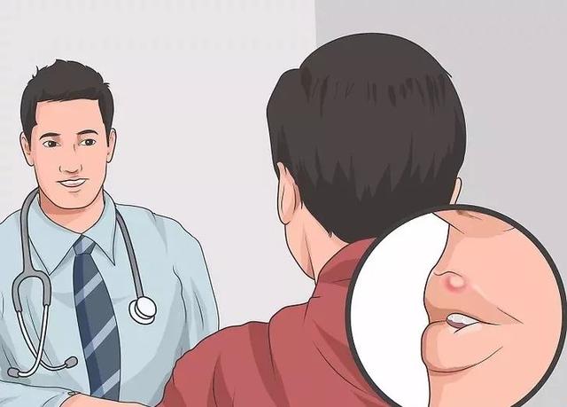 嘴上長泡，暗藏6種致命疾病，做對5件事清火排毒！