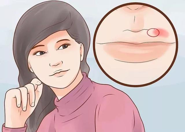 嘴上長泡，暗藏6種致命疾病，做對5件事清火排毒！