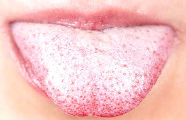 秋天到，要潤燥！ 但一類人越潤問題越大