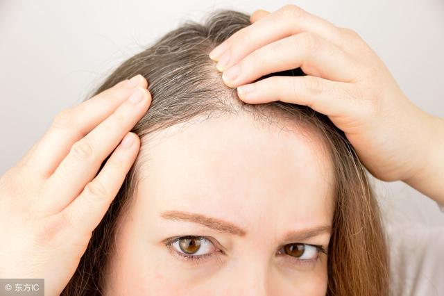 不可忽視！ 白頭髮長在這些位置，預示著你可能得了這些病