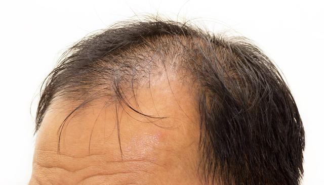 不可忽視！ 白頭髮長在這些位置，預示著你可能得了這些病