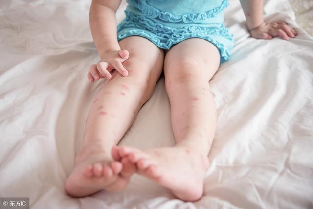 鞋子磨損可能是得病的先兆？ 關鍵看這5個位置！