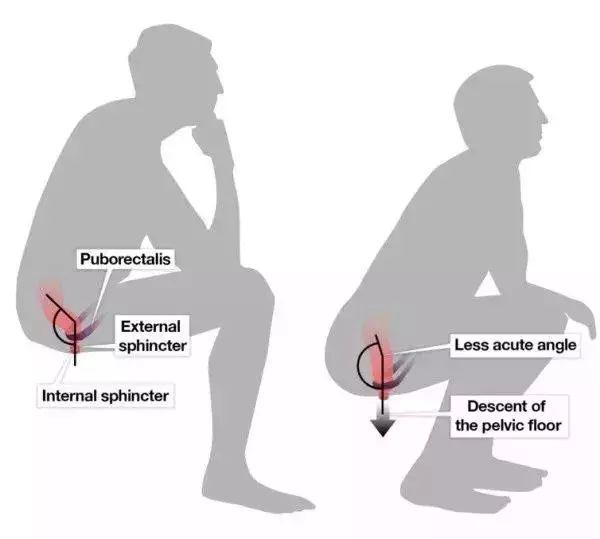 中國式蹲坑席捲全美！ 我們蹲個廁所，怎麼就蹲成了上億的生意？